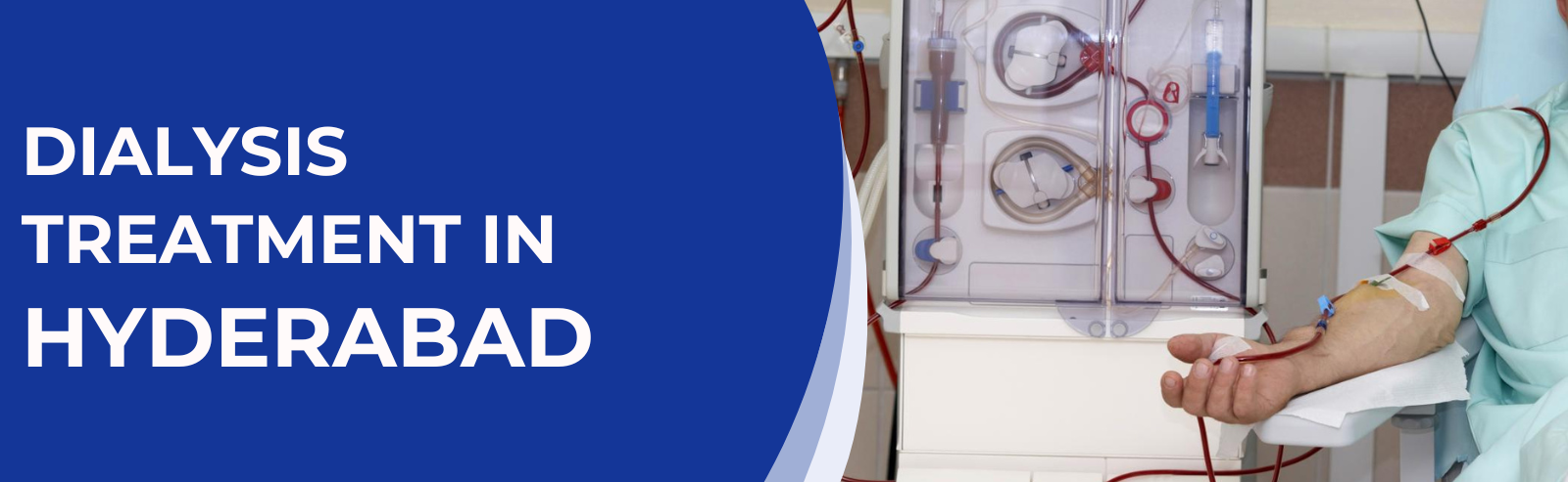 Dialysis Treatment in Hyderabad